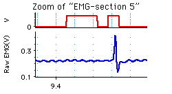 emg response to a tendon tap