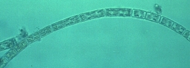 Filamentous Diatom