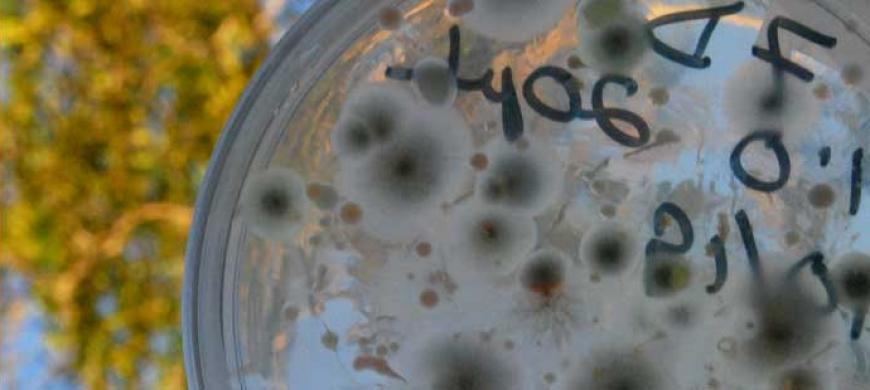 Microbes on petri dish